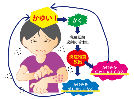 結節性痒疹けっせつせいようしん★金沢薬局