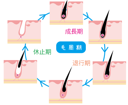 円形脱毛症★金沢薬局